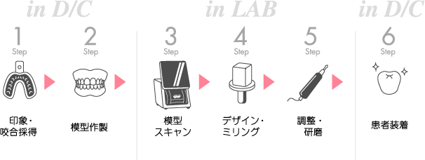 CAD/CAM冠製作フローチャート
